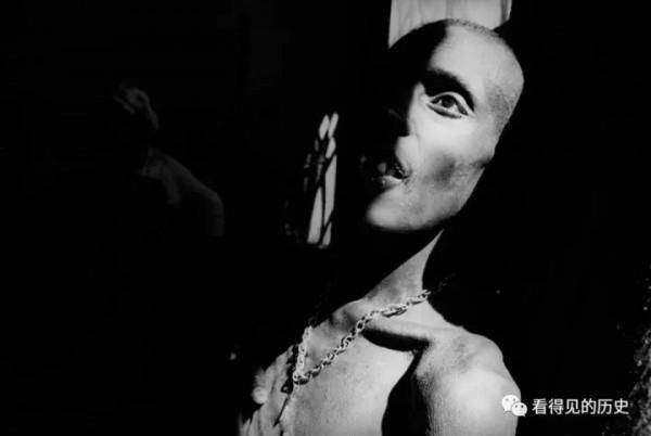 艾滋病橫行的非洲國家辛巴威 那些等死的艾滋病患者