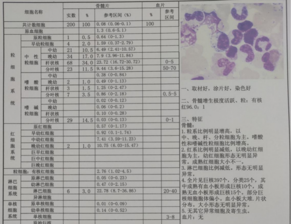 病例分享丨一例慢性髓系白血病急淋變的診斷過程