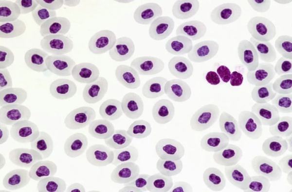 天能VE-586丨免疫組化、Elisa、wb的區別