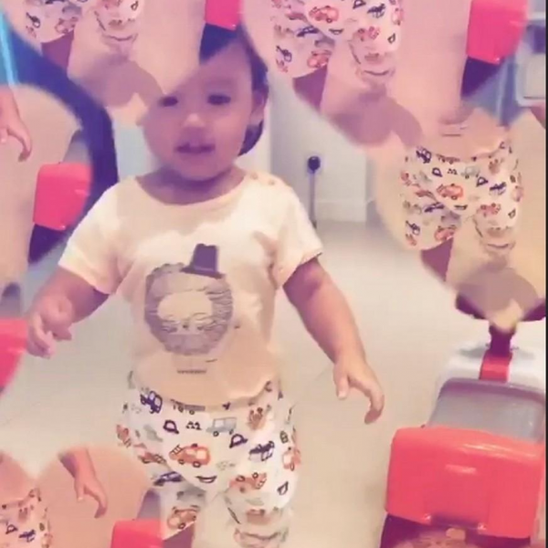 張柏芝被3歲小兒子抓傷臉部，傷口較長且深像刀疤一樣遮都遮不住