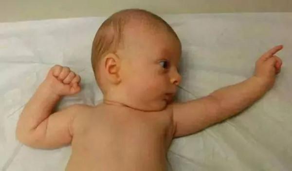 【榕哥烙科】第385期:嬰兒為啥喜歡“投降”睡姿? 【榕哥烙科】第385期:嬰兒為啥喜歡“投降”睡姿?