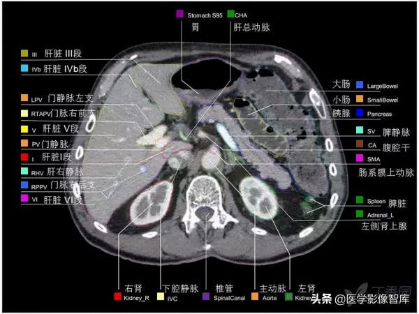 CT斷層解剖圖譜最全總結「推薦收藏」 CT斷層解剖圖譜最全總結「推薦收藏」