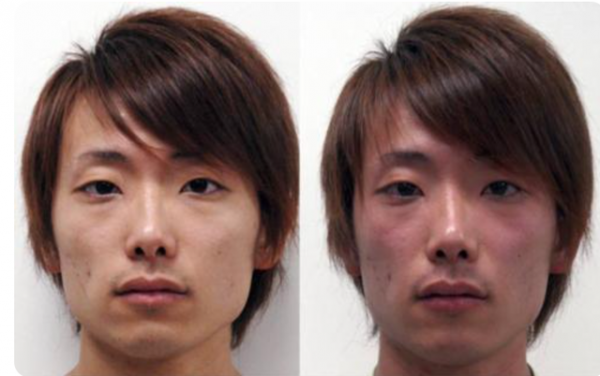 醫生提醒：酒桌上，若碰到一喝酒就臉紅的人，儘量要遠離