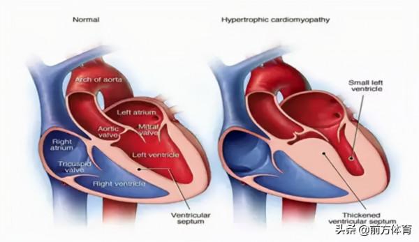一代神鋒悲壯落幕 阿圭羅的痛你也應該懂 一代神鋒悲壯落幕 阿圭羅的痛你也應該懂