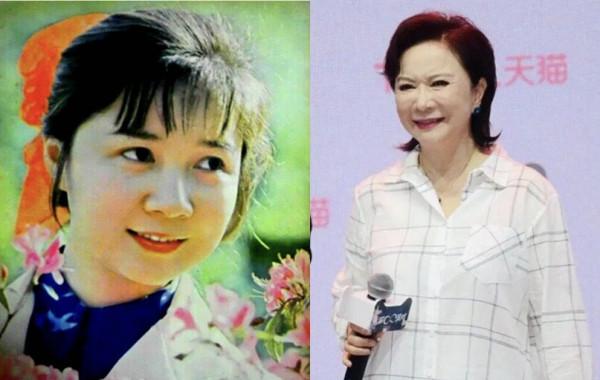 越整越難看後遺症一堆的9位女星！臉像鞋拔子，不敢做大表情