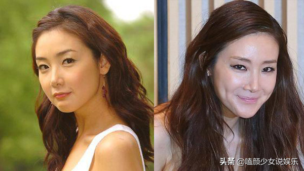 7位紅極一時的韓星今昔對比：整容臉和原裝臉20年後天壤之別