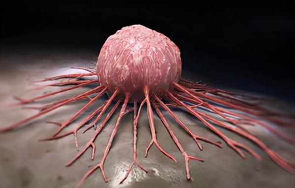 醫生提醒:喝茶不注意方式會增加癌症的風險!注意2點就可以 醫生提醒:喝茶不注意方式會增加癌症的風險!注意2點就可以