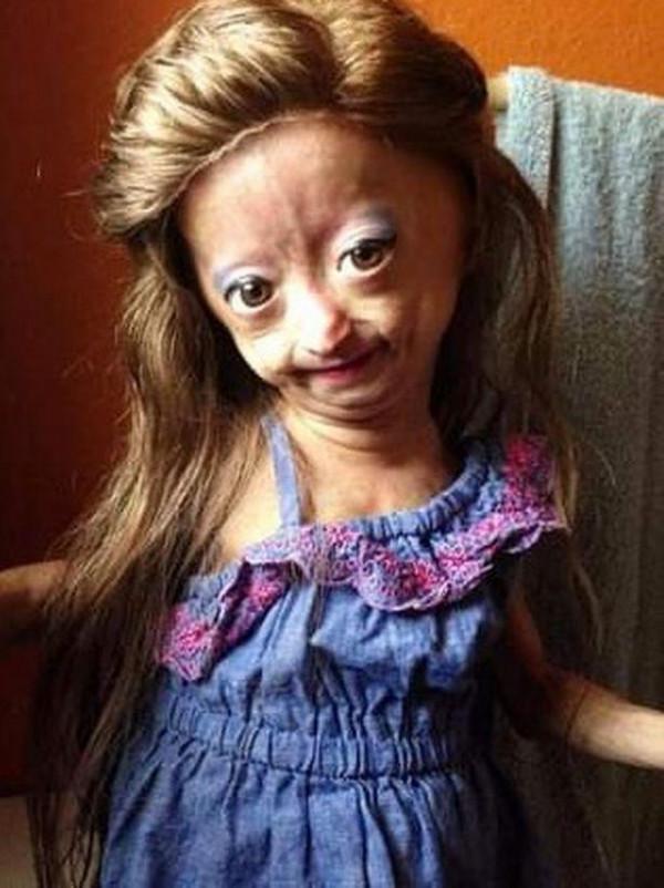 美國少女因早衰症走紅網路，不幸去世年僅15歲，粉絲表示沉痛哀悼