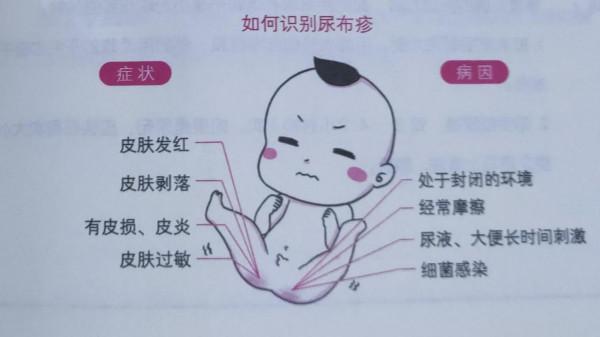 從洗澡穿衣開始吧,呵護嬌嫩的面板,讓新生寶寶健康成長 從洗澡穿衣開始吧,呵護嬌嫩的面板,讓新生寶寶健康成長