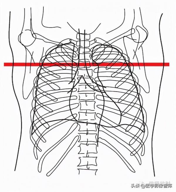 CT斷層解剖圖譜最全總結「推薦收藏」 CT斷層解剖圖譜最全總結「推薦收藏」