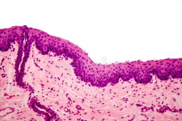 55歲男子咽喉乾燥、發癢，自以為“咽炎”，醫院檢查後男子崩潰了