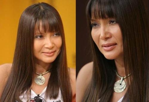 這些年削骨的女明星臉還好嗎?後遺症一大堆,有些都開始崩了 這些年削骨的女明星臉還好嗎?後遺症一大堆,有些都開始崩了