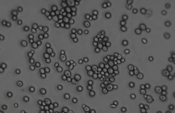 腋窩出現這些問題會引起癢的症狀 主要有四種情況 腋窩出現這些問題會引起癢的症狀 主要有四種情況