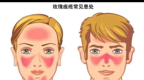 不護膚，就是最好的護膚