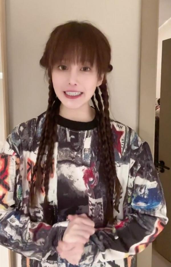 趙本山24歲女兒曬近照!瘦到脫相模樣變化大,網友吐槽牙假被回懟 趙本山24歲女兒曬近照!瘦到脫相模樣變化大,網友吐槽牙假被回懟