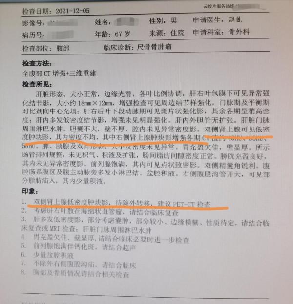 劉懿博士說肺癌（三〇六亖）幹農活手臂疼，住院檢查疑似晚期肺癌