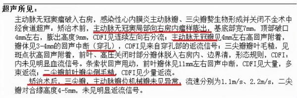 30歲小夥多次發燒胸悶,竟是心臟出了問題!醫生:別不當回事 30歲小夥多次發燒胸悶,竟是心臟出了問題!醫生:別不當回事