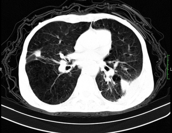 經常做夢睡不著覺肝火旺，氣血不足、陰虛燥熱你佔哪一個？