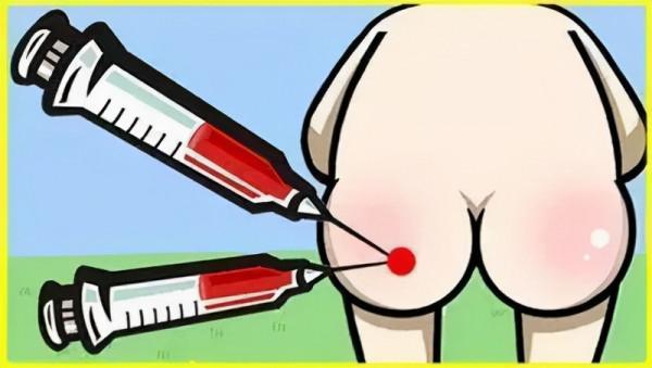 小時候常打的“屁股針”,見效快又便宜,為什麼現在消失了? 小時候常打的“屁股針”,見效快又便宜,為什麼現在消失了?