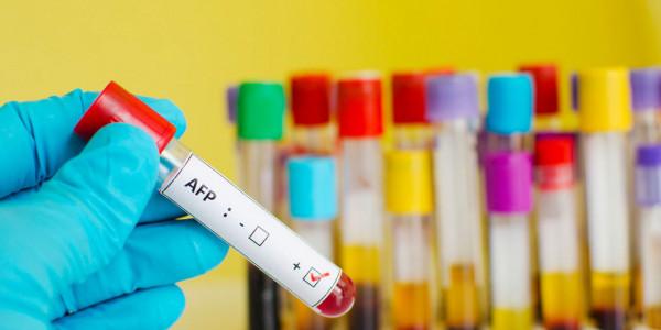 肝功能正常不代表肝臟正常,也可能患癌,這3項檢查要注意 肝功能正常不代表肝臟正常,也可能患癌,這3項檢查要注意