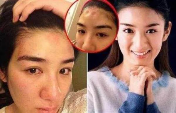 4位嫁入豪門被家暴的女明星，有的差點被毀容，有的終於找到幸福