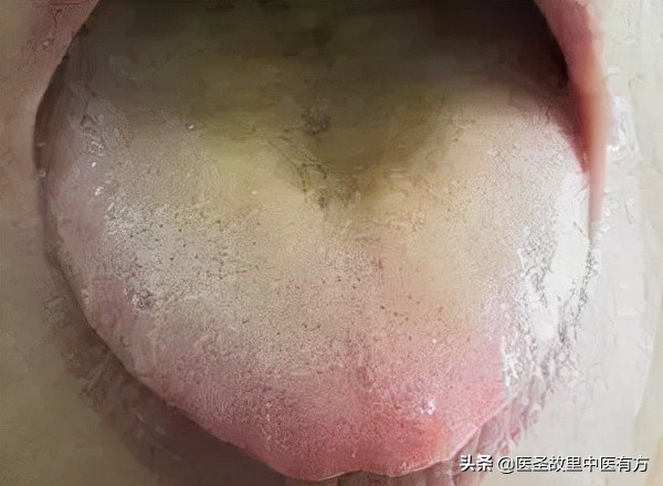 中藥十大名方之黃連溫膽湯，辨證加減，可治甲狀腺結節等多種疾病