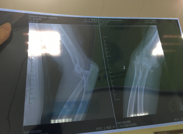 今日奇葩：小米這腦洞也太大了吧