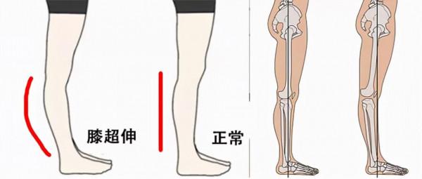 “白晶晶”的腿價值3000萬？別不信，做好這幾點你也能擁有
