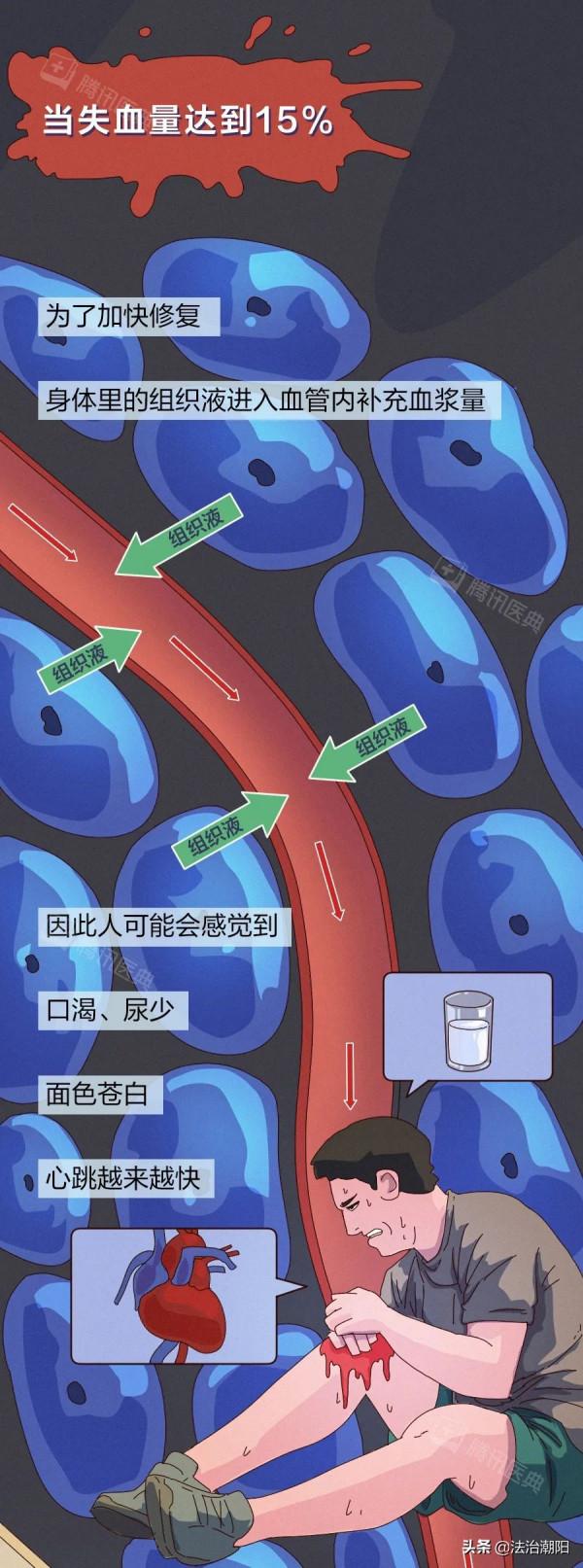 人止不住的大出血，到底有多可怕？
