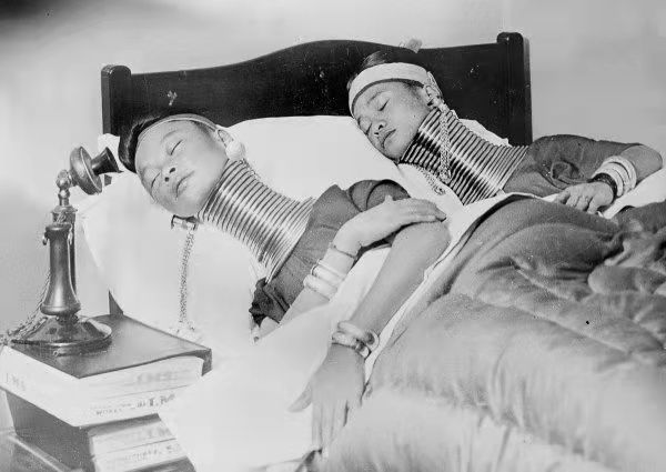 “天鵝頸”？欣賞不來