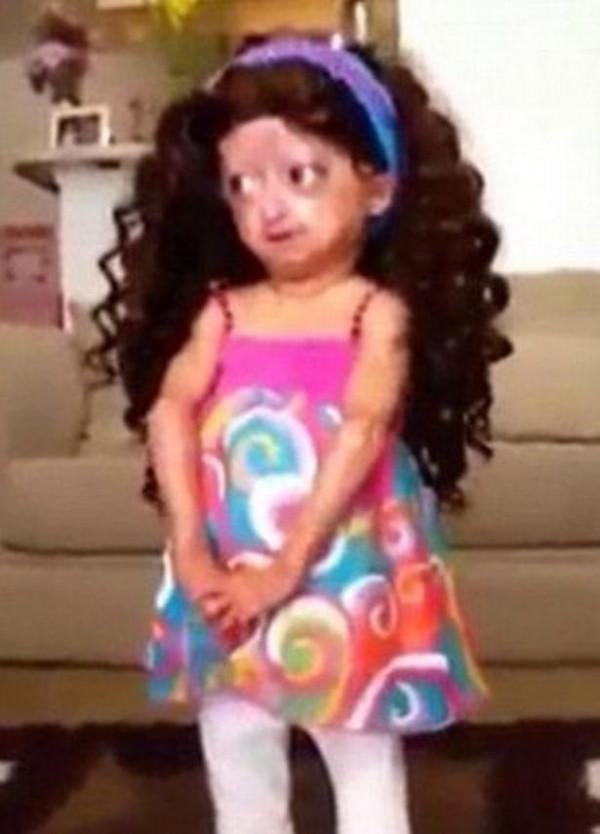 美國少女因早衰症走紅網路，不幸去世年僅15歲，粉絲表示沉痛哀悼