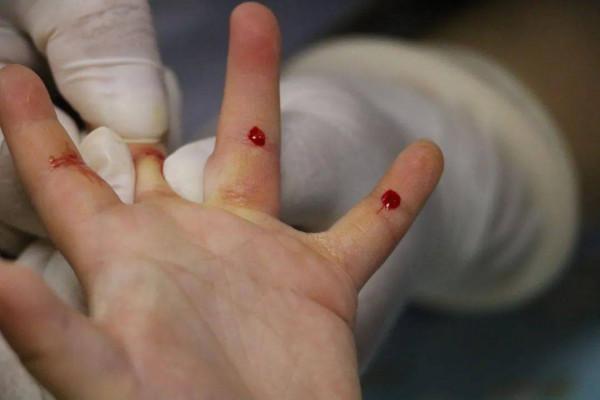 寶寶不吃飯日漸消瘦可能是疳積，歐陽醫生教你辨別孩子是否有疳積