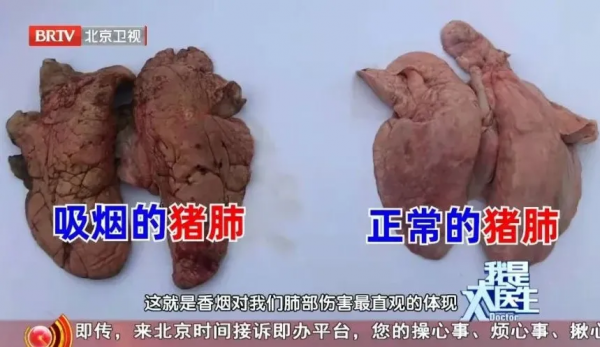 晚期肺癌也能有效“逆轉”？2大肺部“殺手”，就在你身邊