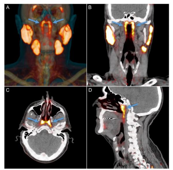 又發現人類在進化的證據了？