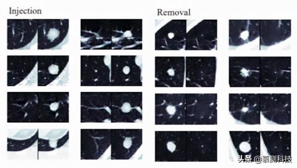CT-GAN：利用深度學習惡意篡改三維醫學影象