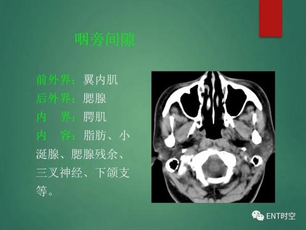 頭頸五官CT斷層解剖圖及常見病影像診斷