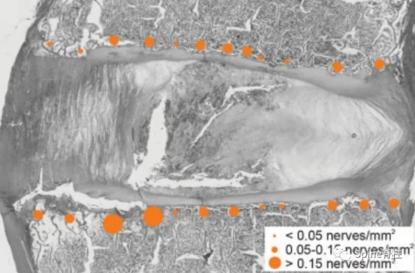 椎間盤源性腰痛 (discogenic low back pain) 椎間盤源性腰痛 (discogenic low back pain)