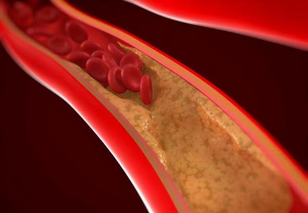 山東42歲女子,每天吃洋蔥降血脂,後來身體怎麼樣了? 山東42歲女子,每天吃洋蔥降血脂,後來身體怎麼樣了?