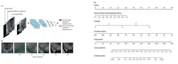 年度回顧丨朱耀教授：2021年值得一讀的十項前列腺癌研究