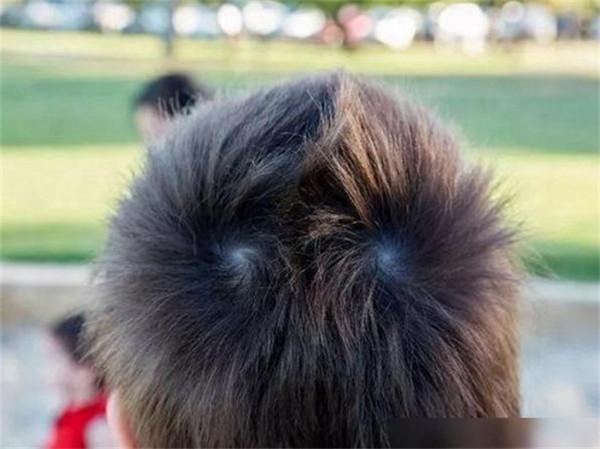 孩子的頭頂有兩個“旋”暗示更聰明?一個科學實驗告訴你答案 孩子的頭頂有兩個“旋”暗示更聰明?一個科學實驗告訴你答案