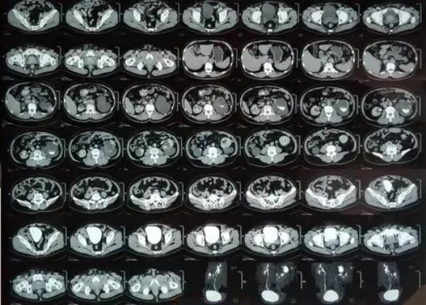 B超、CT、磁共振都是影像檢查，分別基於什麼原理，有什麼利弊？