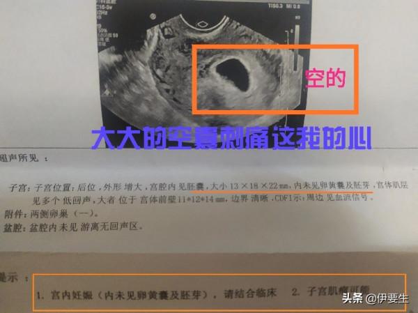 為了成為媽媽，我都經歷了什麼劫？