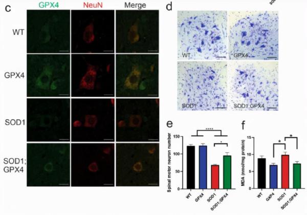 肌萎縮側索硬化症中鐵死亡介導選擇性運動神經元死亡
