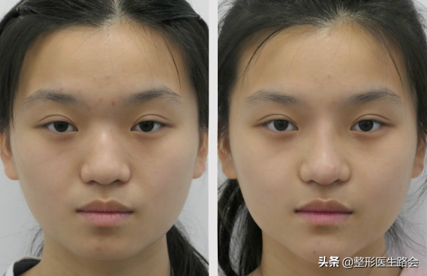 整得再美，也是“一眼假”！想要悄悄變美，怎麼就那麼難？