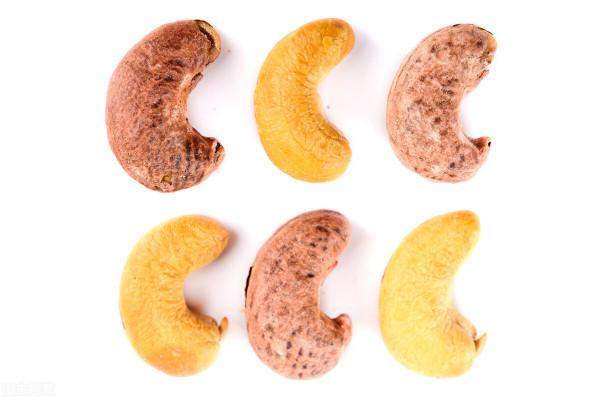 肝病患者能吃堅果嗎? 肝病患者能吃堅果嗎?