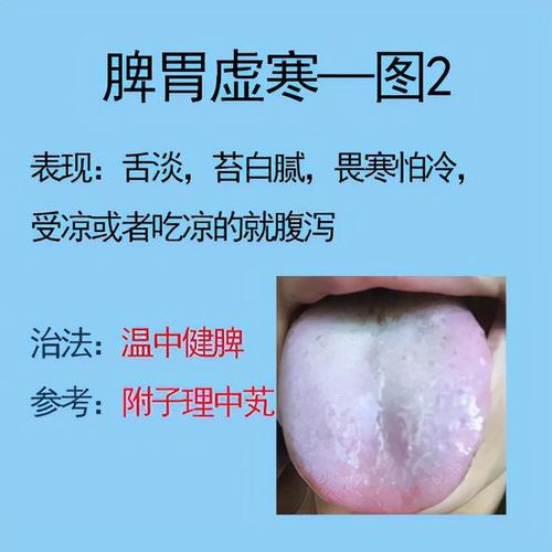 脾虛有四類，你要分清楚，對症養脾