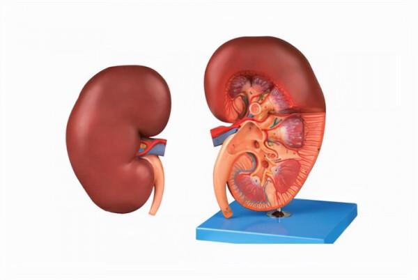 醫生告訴你得了腎衰竭應該怎麼護理，做好這四個方面