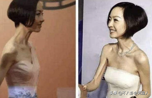 ​瘦到病態、動臉成癮、強行裝嫩，內娛的畸形審美真可怕