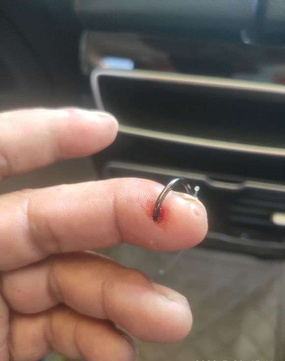 盤點釣魚人各種花式釣自己，看著就很疼！預防和處理方法分享