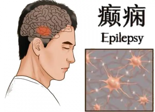 歪打正著的藥物（一）